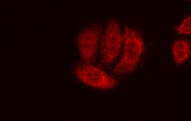 TRPM7 Antibody in Immunocytochemistry (ICC/IF)
