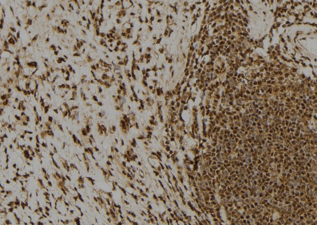 Claspin Antibody in Immunohistochemistry (Paraffin) (IHC (P))