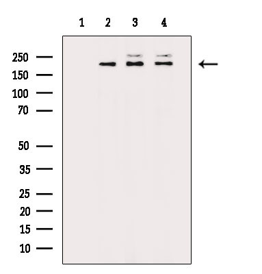 RICTOR Antibody in Western Blot (WB)