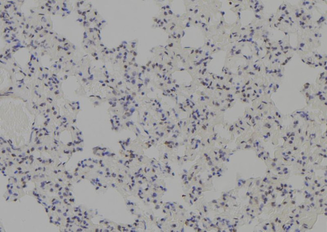 MDMX Antibody in Immunohistochemistry (Paraffin) (IHC (P))