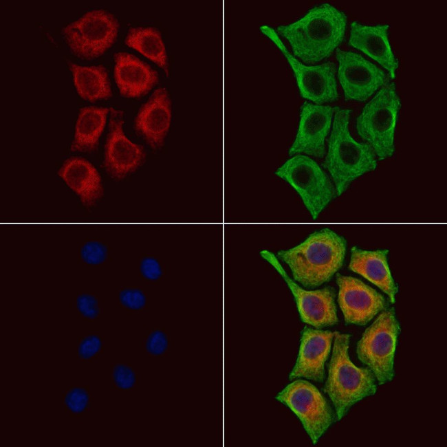 CSNK2B Antibody in Immunocytochemistry (ICC/IF)