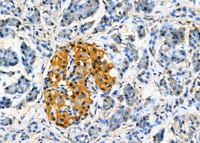 TMX2 Antibody in Immunohistochemistry (Paraffin) (IHC (P))