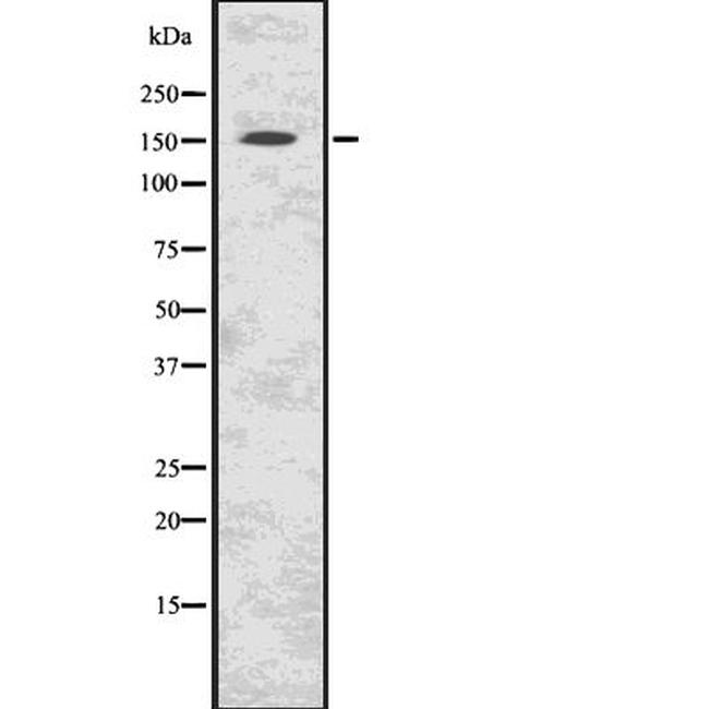 C11orf30 Antibody in Western Blot (WB)