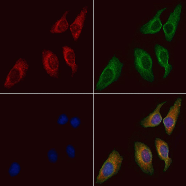 ARHGAP5 Antibody in Immunocytochemistry (ICC/IF)