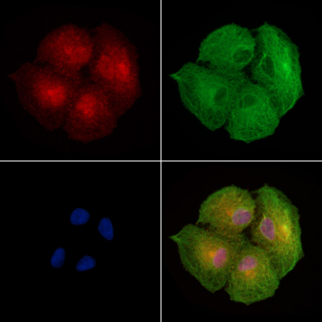 EPS15R Antibody in Immunocytochemistry (ICC/IF)