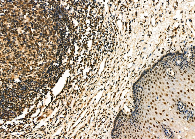 IRS4 Antibody in Immunohistochemistry (Paraffin) (IHC (P))