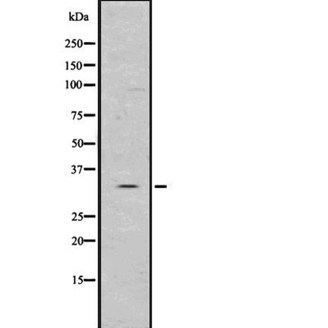 ILP-2 Antibody in Western Blot (WB)