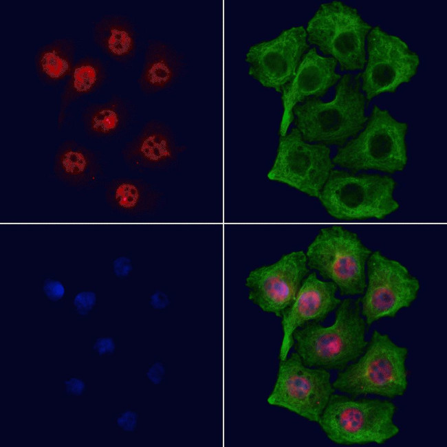 GLIS3 Antibody in Immunocytochemistry (ICC/IF)