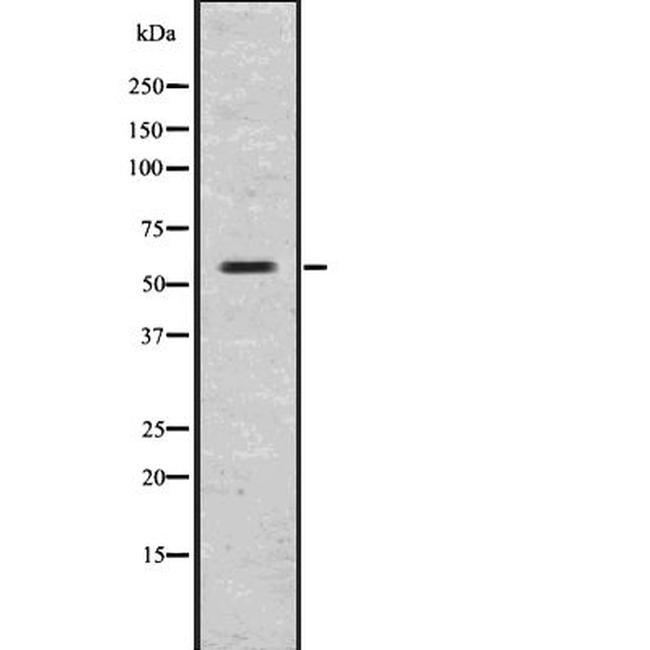GLP1R Antibody in Western Blot (WB)