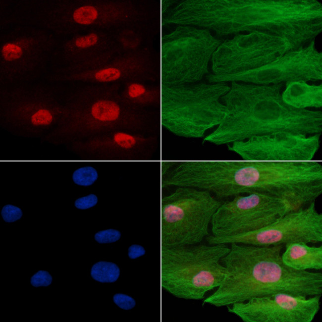 ZNF306 Antibody in Immunocytochemistry (ICC/IF)