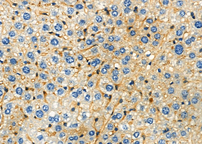 SOAT1 Antibody in Immunohistochemistry (Paraffin) (IHC (P))