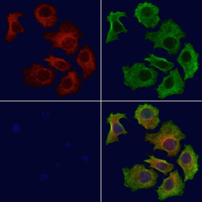 GNB2 Antibody in Immunocytochemistry (ICC/IF)