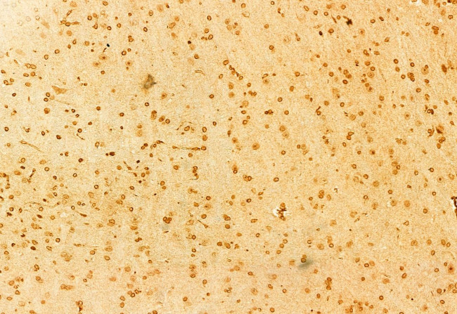 PLD1 Antibody in Immunohistochemistry (Paraffin) (IHC (P))