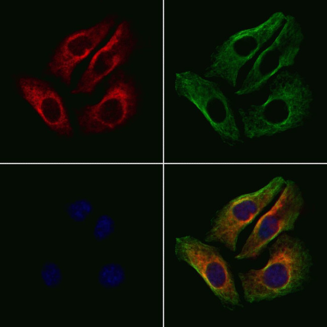 alpha-II Spectrin Antibody in Immunocytochemistry (ICC/IF)