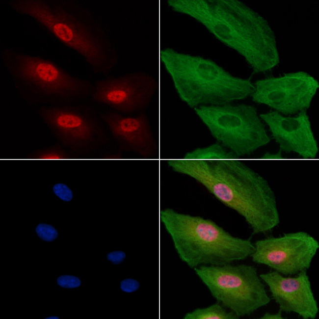H3F3A Antibody in Immunocytochemistry (ICC/IF)