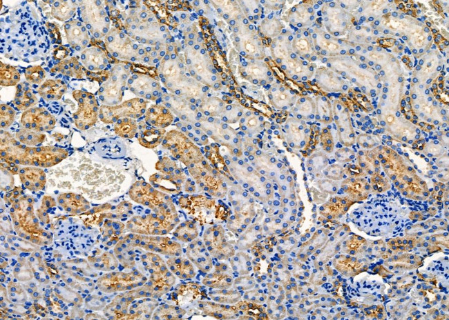 SULT1A4 Antibody in Immunohistochemistry (Paraffin) (IHC (P))