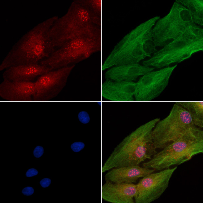 PHD1 Antibody in Immunocytochemistry (ICC/IF)