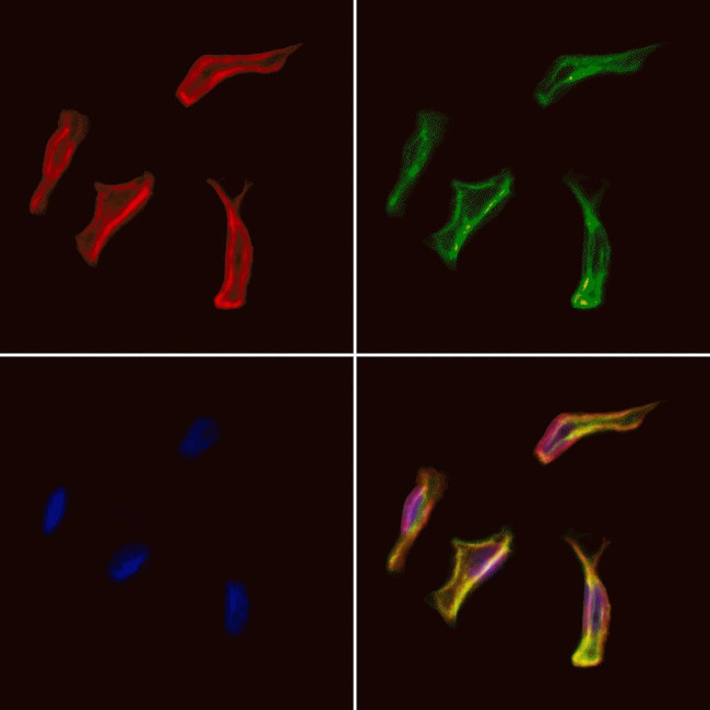 EHD1 Antibody in Immunocytochemistry (ICC/IF)