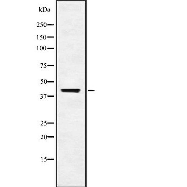 USP18 Antibody in Western Blot (WB)