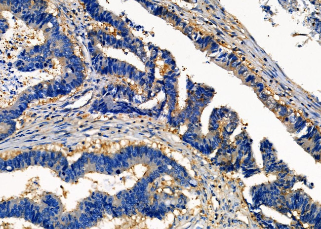 MESDC2 Antibody in Immunohistochemistry (Paraffin) (IHC (P))