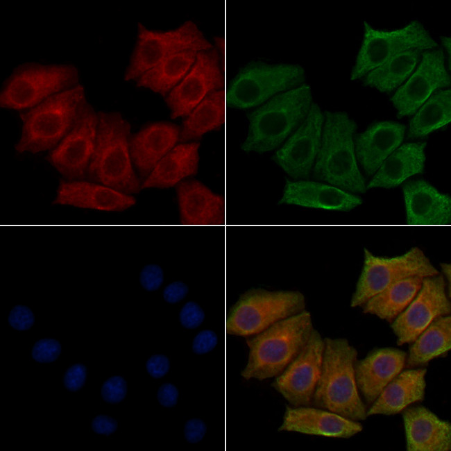 CA125 Antibody in Immunocytochemistry (ICC/IF)