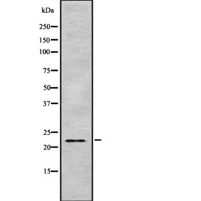 ARFRP1 Antibody in Western Blot (WB)