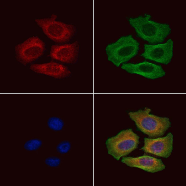 RASGRF1 Antibody in Immunocytochemistry (ICC/IF)