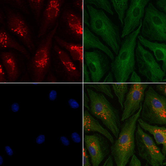 KATNA1 Antibody in Immunocytochemistry (ICC/IF)
