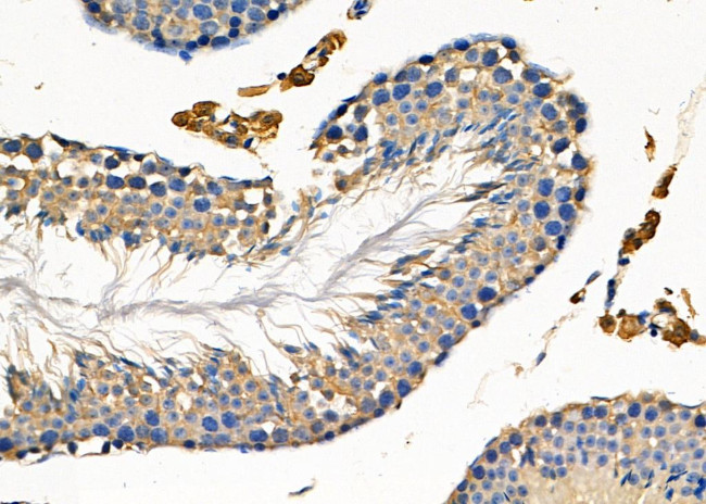 FAIM3 Antibody in Immunohistochemistry (Paraffin) (IHC (P))