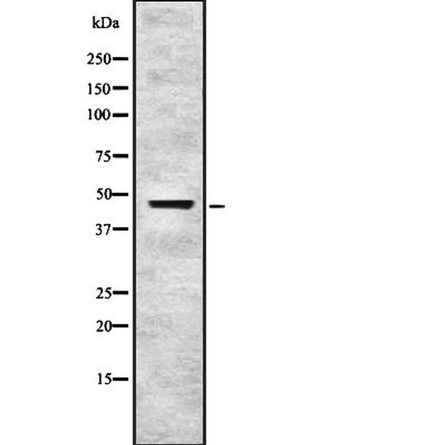 ING3 Antibody in Western Blot (WB)