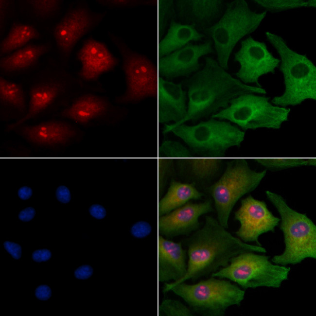 PBX3 Antibody in Immunocytochemistry (ICC/IF)