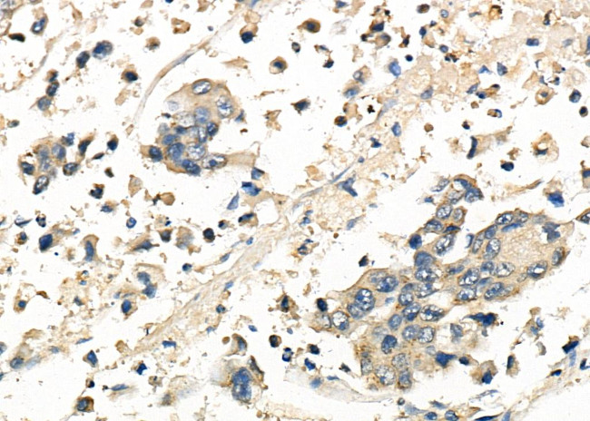 FRAT1 Antibody in Immunohistochemistry (Paraffin) (IHC (P))