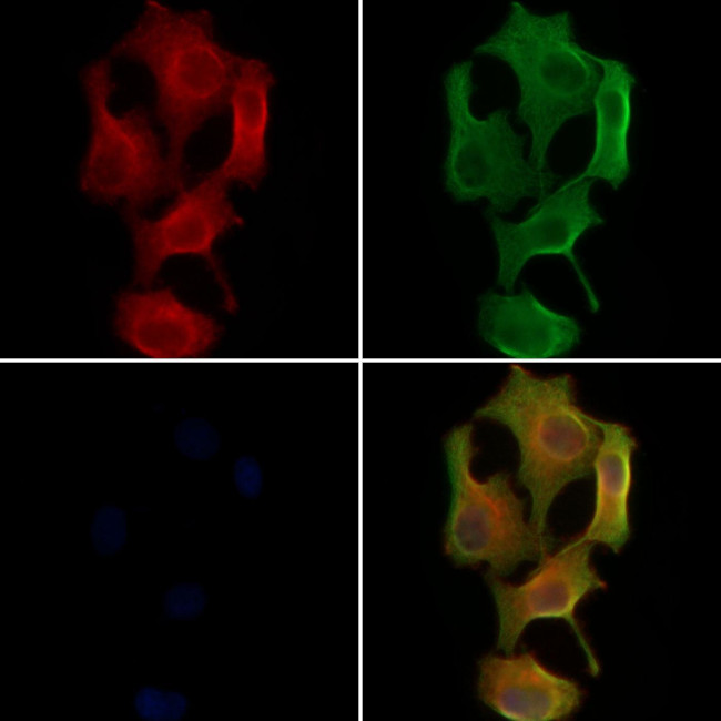 PTS Antibody in Immunocytochemistry (ICC/IF)