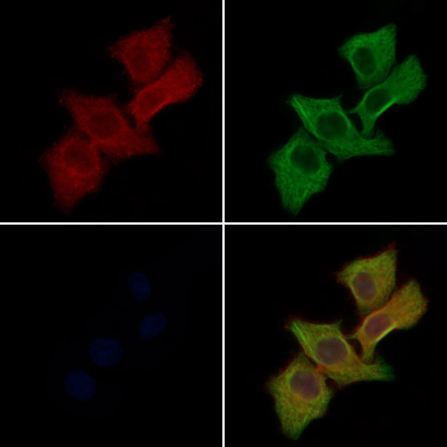 CDH4 Antibody in Immunocytochemistry (ICC/IF)
