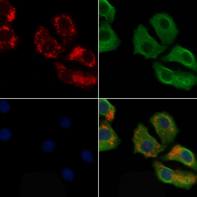 IGHG1 Antibody in Immunocytochemistry (ICC/IF)