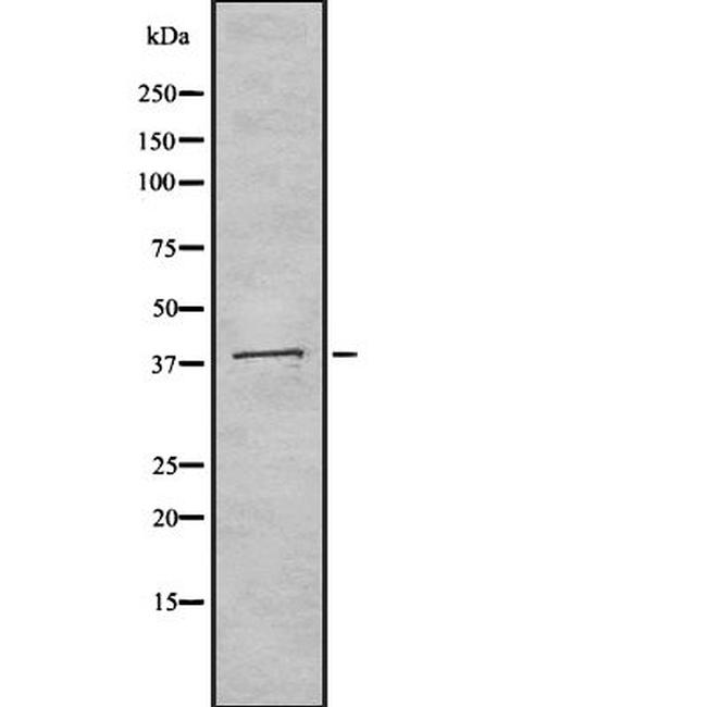Biglycan Antibody in Western Blot (WB)