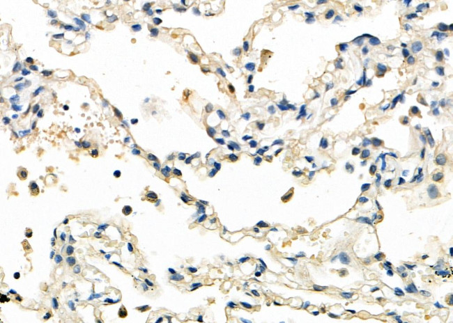 MLLT11 Antibody in Immunohistochemistry (Paraffin) (IHC (P))