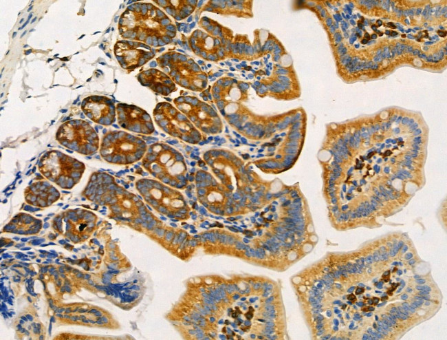 TRAM2 Antibody in Immunohistochemistry (Paraffin) (IHC (P))