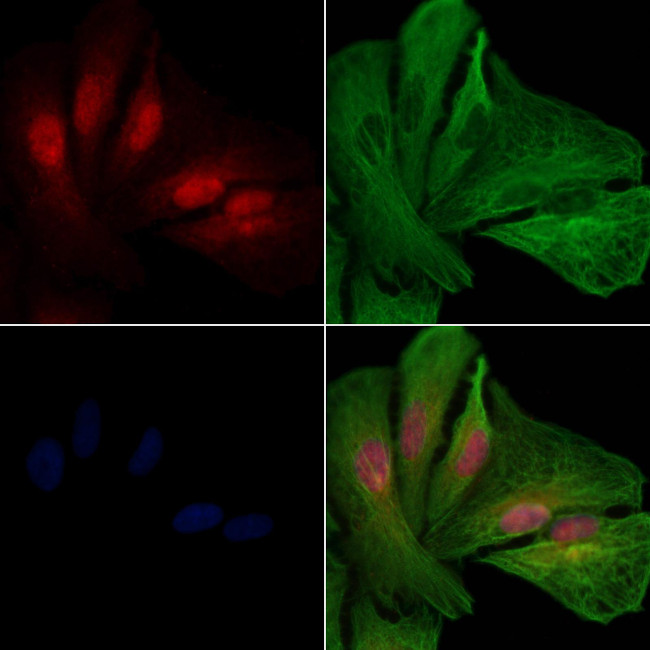 UBE2M Antibody in Immunocytochemistry (ICC/IF)