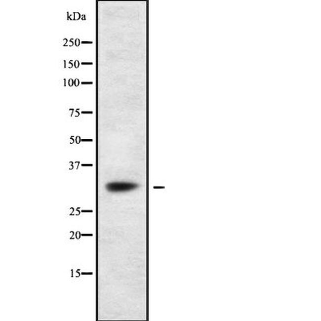 TRAP alpha Antibody in Western Blot (WB)