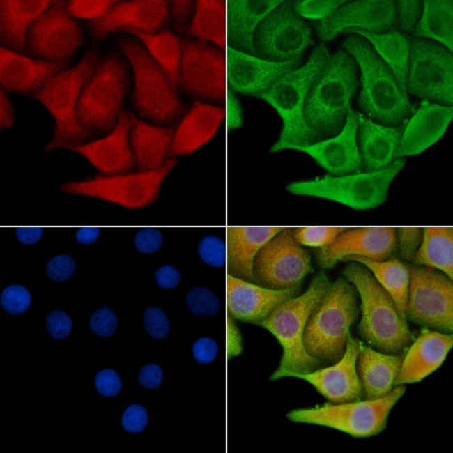 Talin 2 Antibody in Immunocytochemistry (ICC/IF)