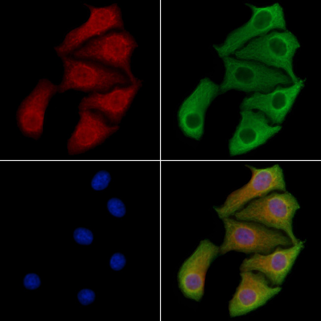 PPP1R9A Antibody in Immunocytochemistry (ICC/IF)