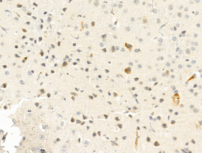 Factor V Antibody in Immunohistochemistry (Paraffin) (IHC (P))