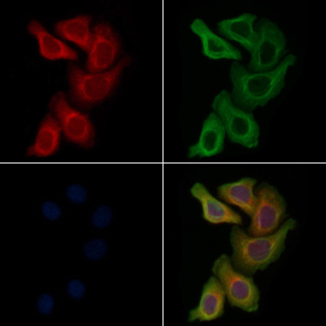 KIF3A Antibody in Immunocytochemistry (ICC/IF)