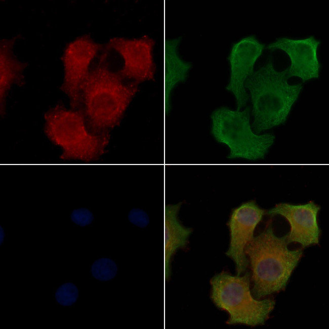 ORM2 Antibody in Immunocytochemistry (ICC/IF)