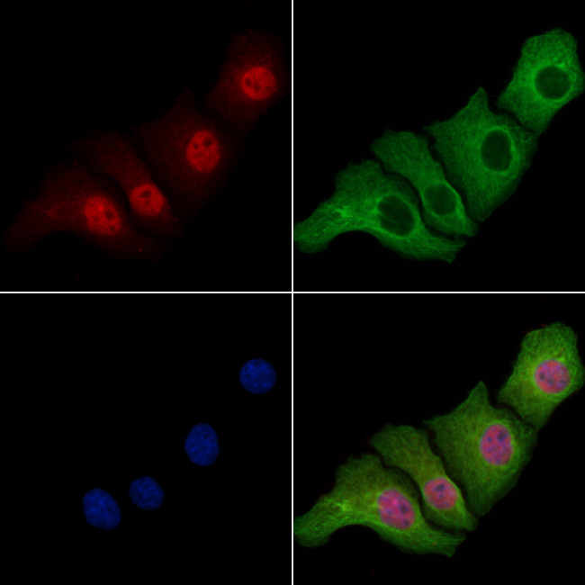 CDX4 Antibody in Immunocytochemistry (ICC/IF)