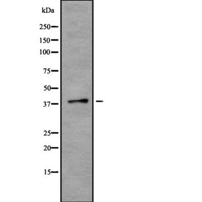 TMOD2 Antibody in Western Blot (WB)