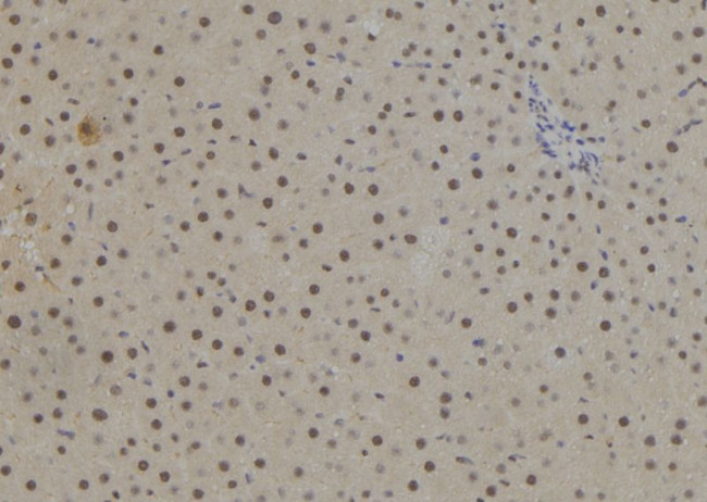 TLX Antibody in Immunohistochemistry (Paraffin) (IHC (P))