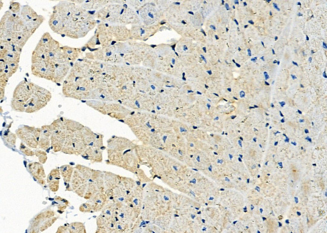 MYL4 Antibody in Immunohistochemistry (Paraffin) (IHC (P))