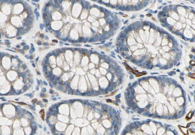 CD93 Antibody in Immunohistochemistry (Paraffin) (IHC (P))